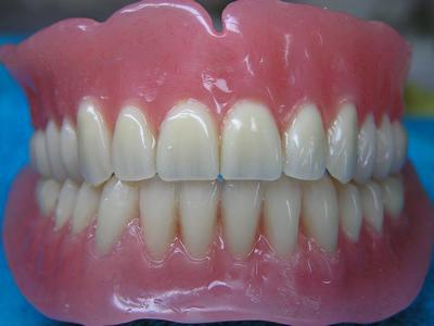 Cъемные зубные протезы при полном отсутствии зубов